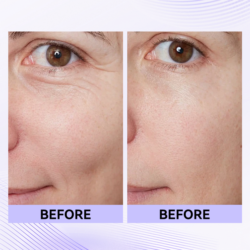 Last 3 Hours:š„ Up to 15% OFF ā Instant Eye Tightener Easy-Wear Formula