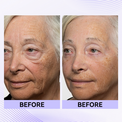 Last 3 Hours:🔥 Up to 15% OFF – Instant Eye Tightener Easy-Wear Formula