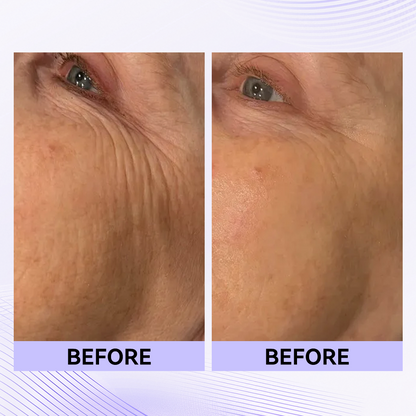 Last 3 Hours:🔥 Up to 15% OFF – Instant Eye Tightener Easy-Wear Formula