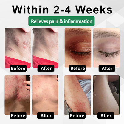 Snake Peptide Shingles Skincare Ampoules