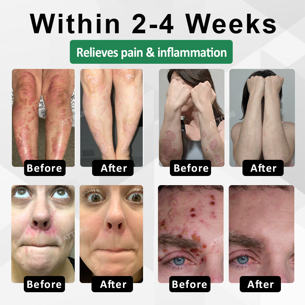 Snake Peptide Shingles Skincare Ampoules